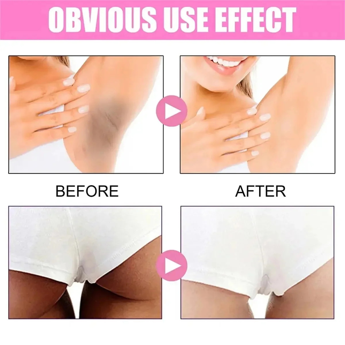 Whitening Cream Private Parts  - Niacinamide Brightening Serum 评论和价格